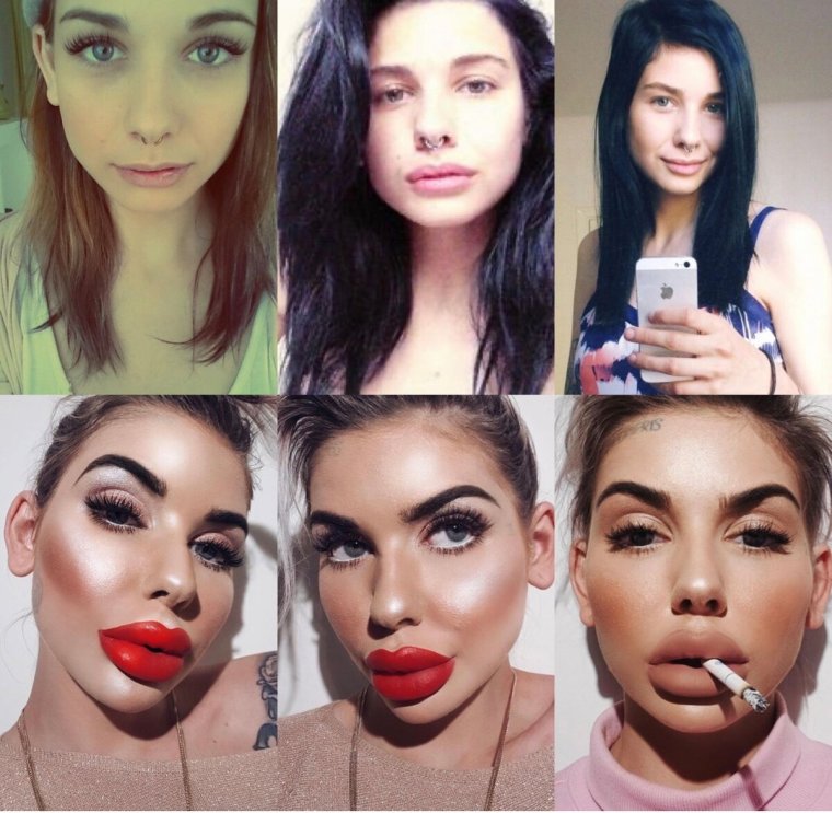 Девушки с пластическими операциями