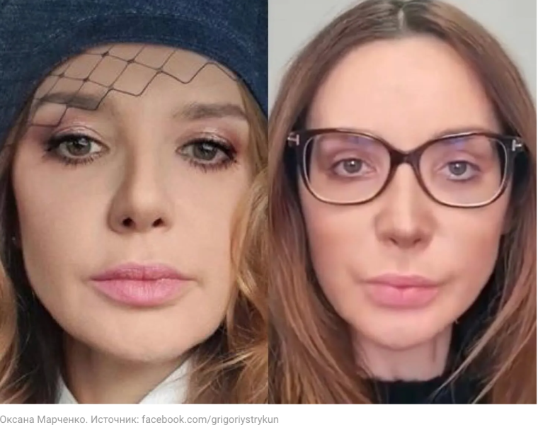 Оксана Марченко пластика