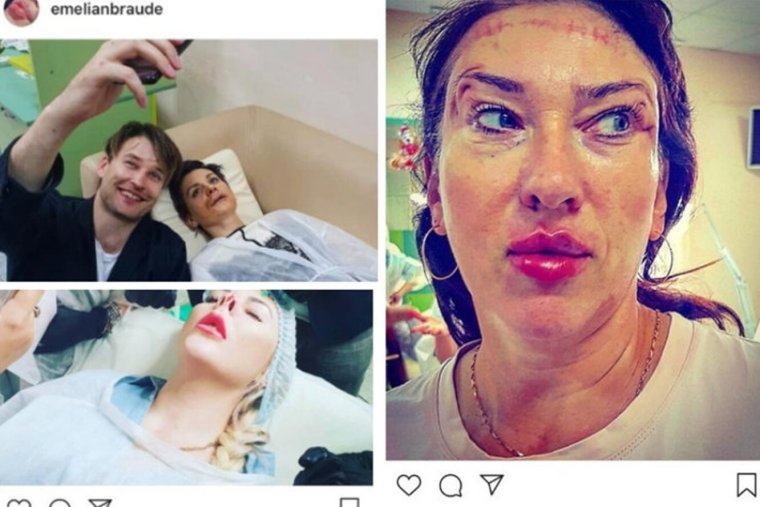 Емельян Брауде губы ТП