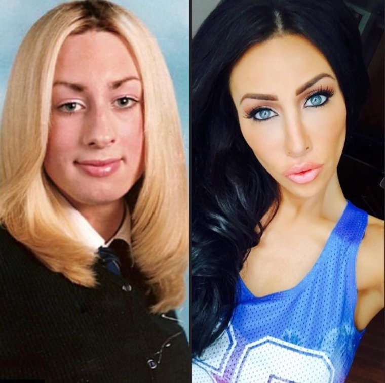 Девицы до и после пластики