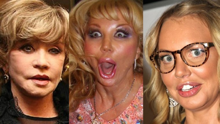 Изуродованные пластикой Мисс