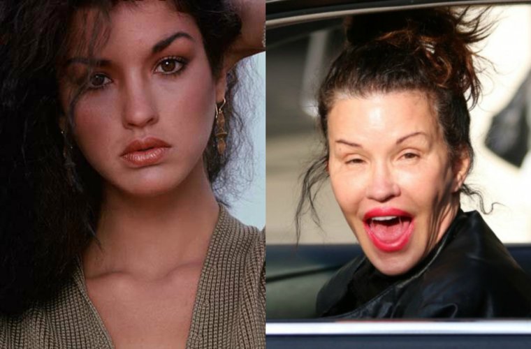 Неудачная пластика звезд