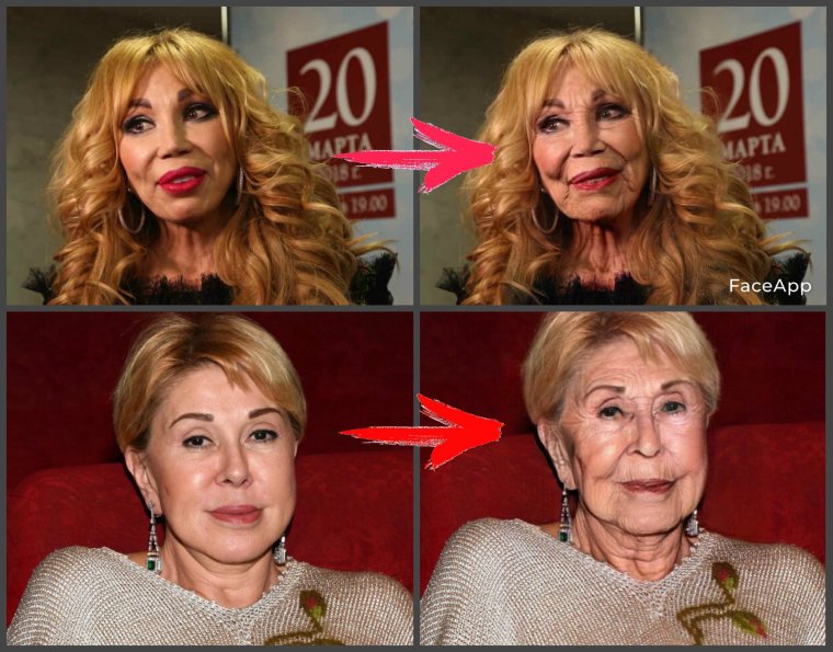 Звезды после ботокса