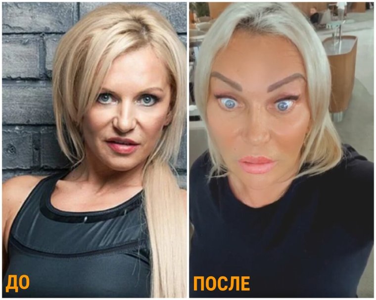Елена Санжаровская и пластические операции