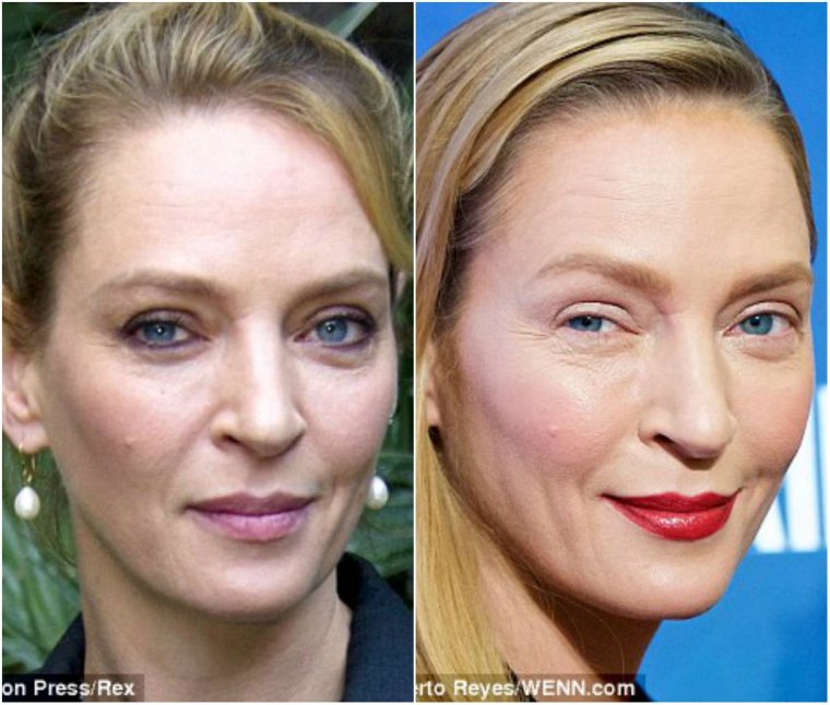 Ума Турман после пластической операции