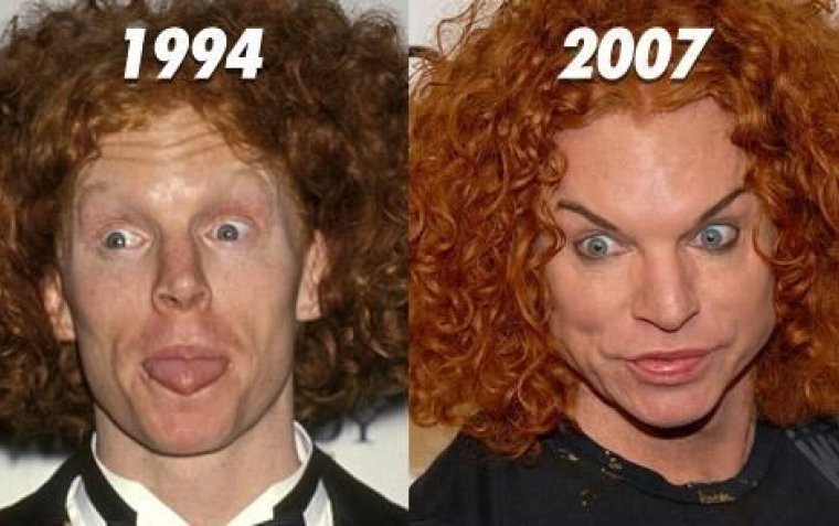 Самые уродливые пластические операции