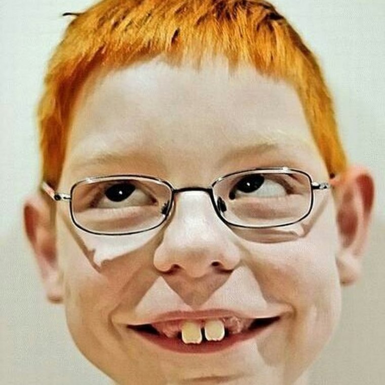 Толстый школьник в очках