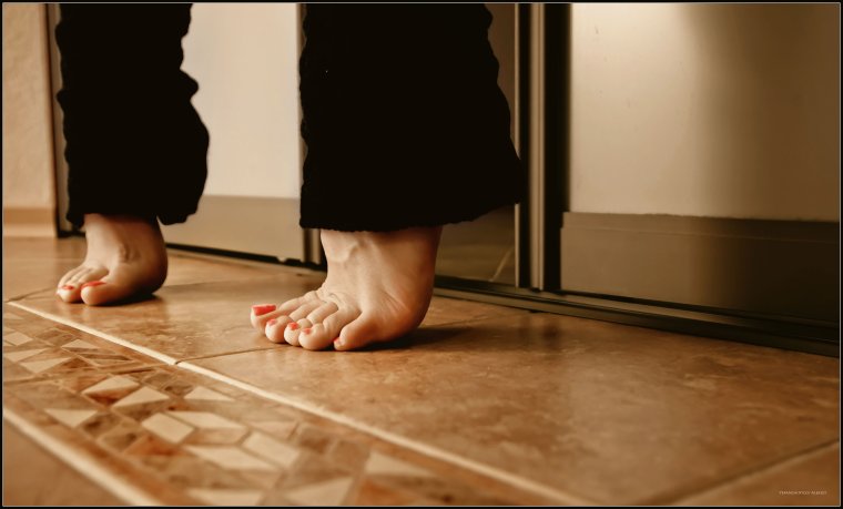 Удлинение ног аппаратом Илизарова