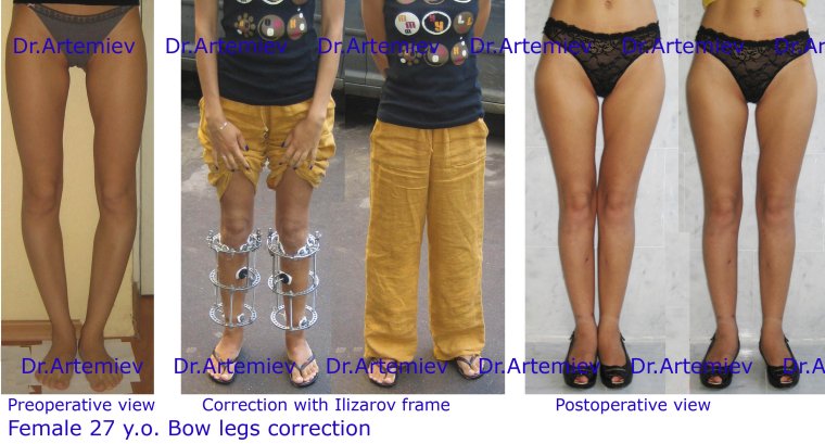 Красивые ноги в шортах