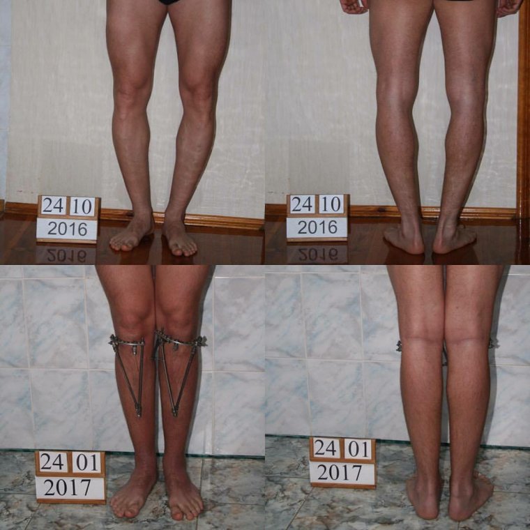 Ноги мужчины