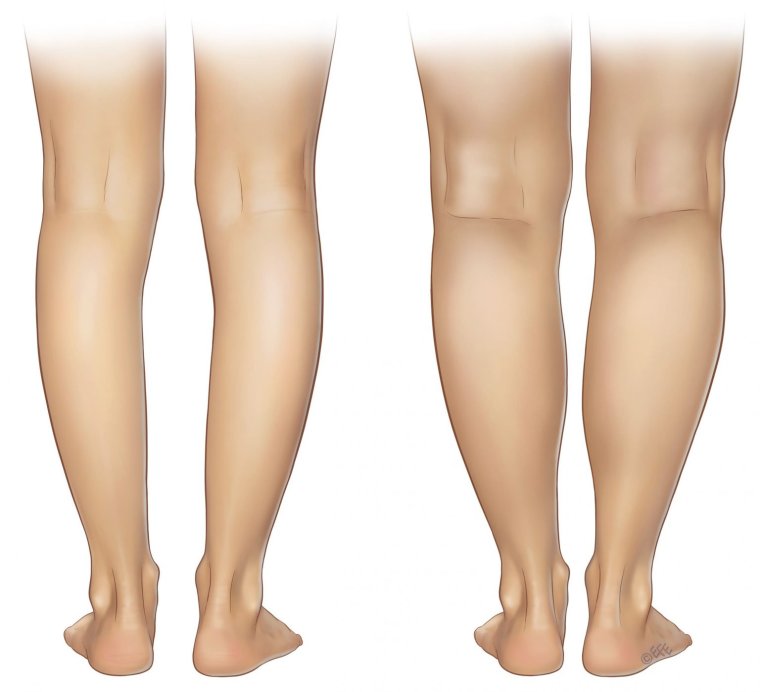 Overtime Original Mix r3ckzet