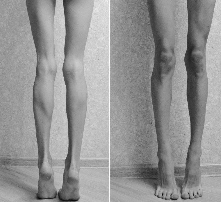 Женская стопа референс