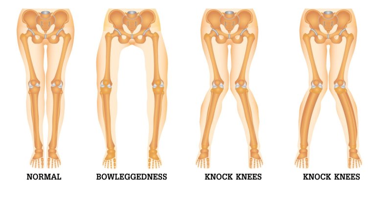 Фигура кореянок