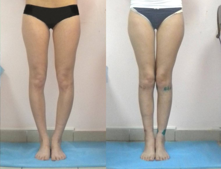 Красивые женские ноги с боку