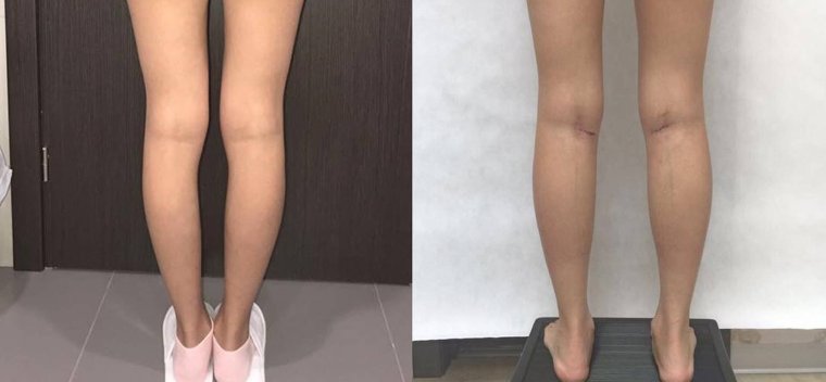 Стройные ножки