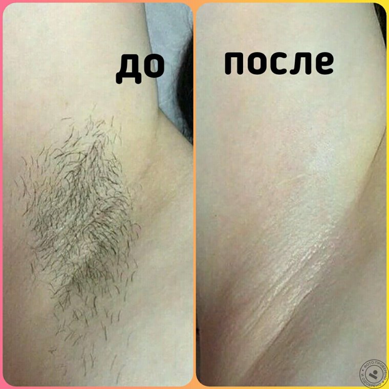 Высказывания о депиляции