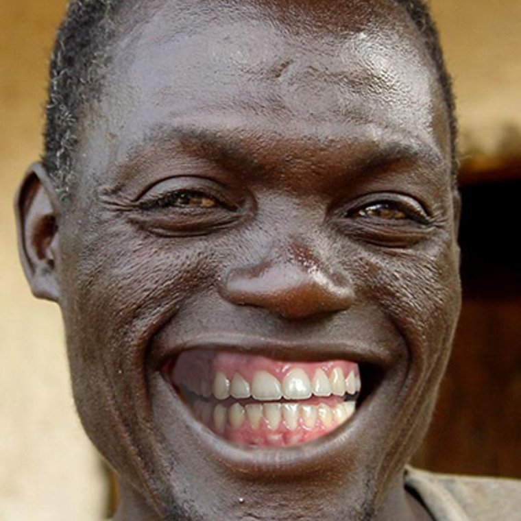 Темнокожий даун