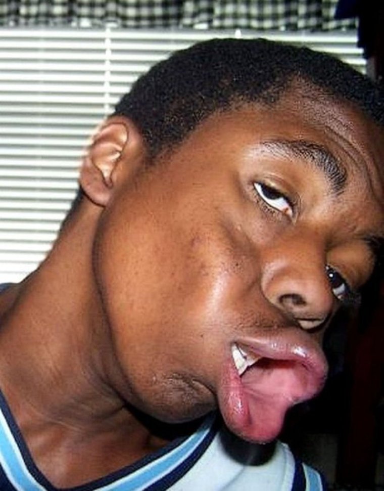 Магшот Трэвиса