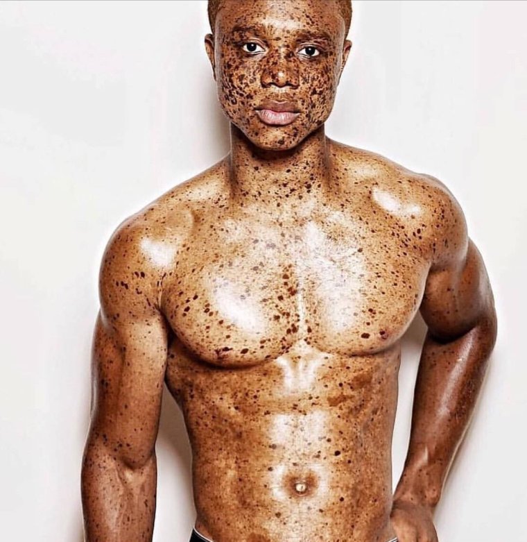 Австрало негроидная раса альбиносы