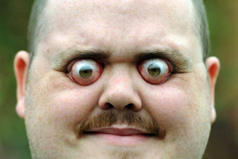 Дети с веснушками