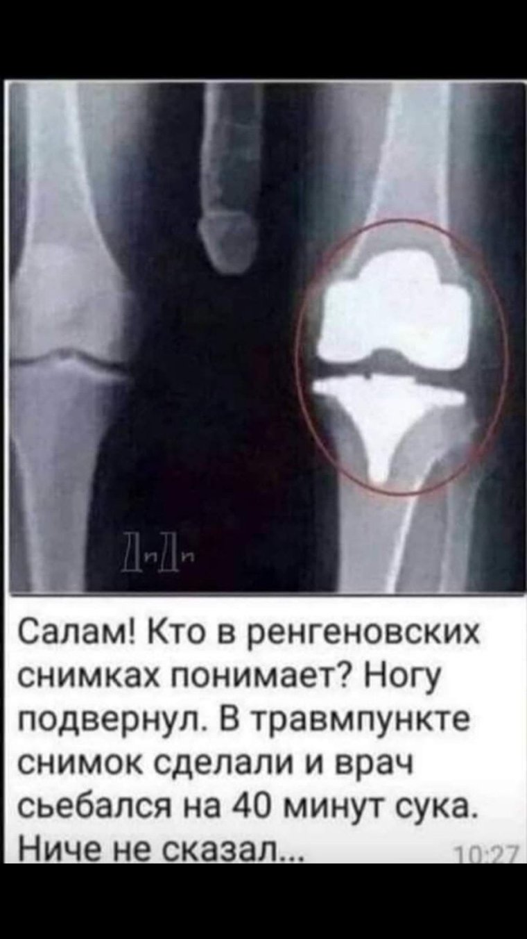 Прикол снимок рентгена коленного сустава