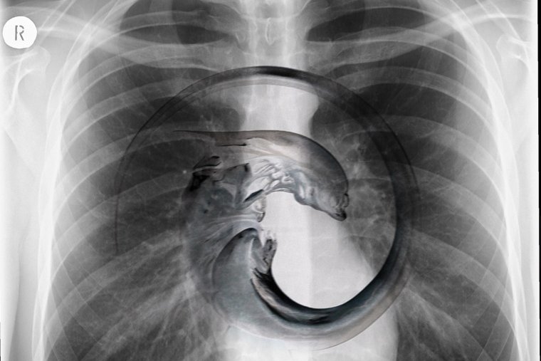 Рентгеновский снимок