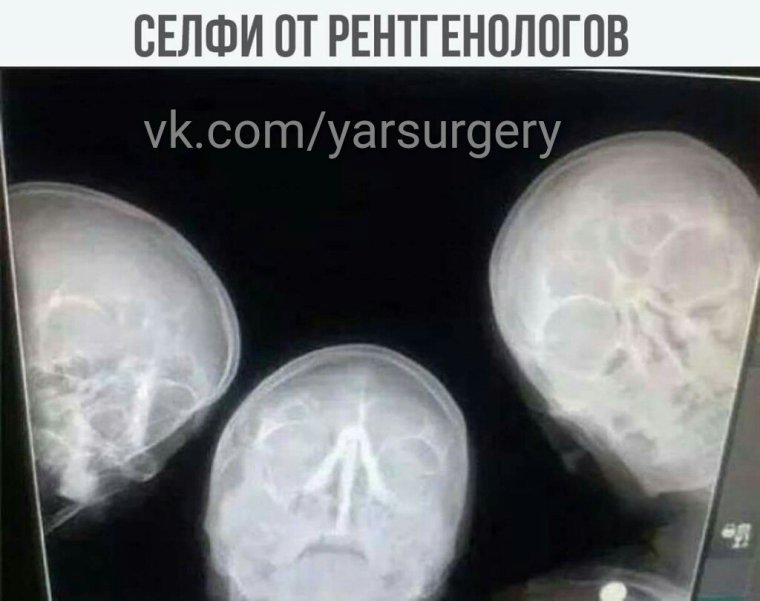 Шутки про рентген