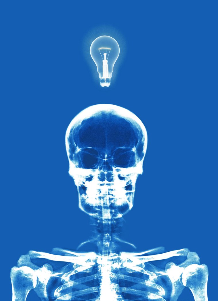 Красивый рентген