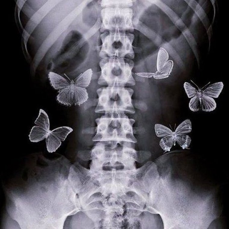 Рентген Мем