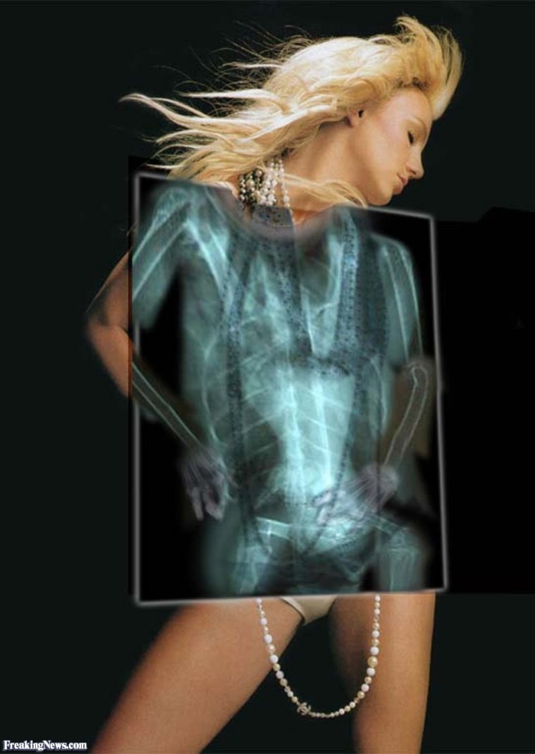 У меня кость широкая