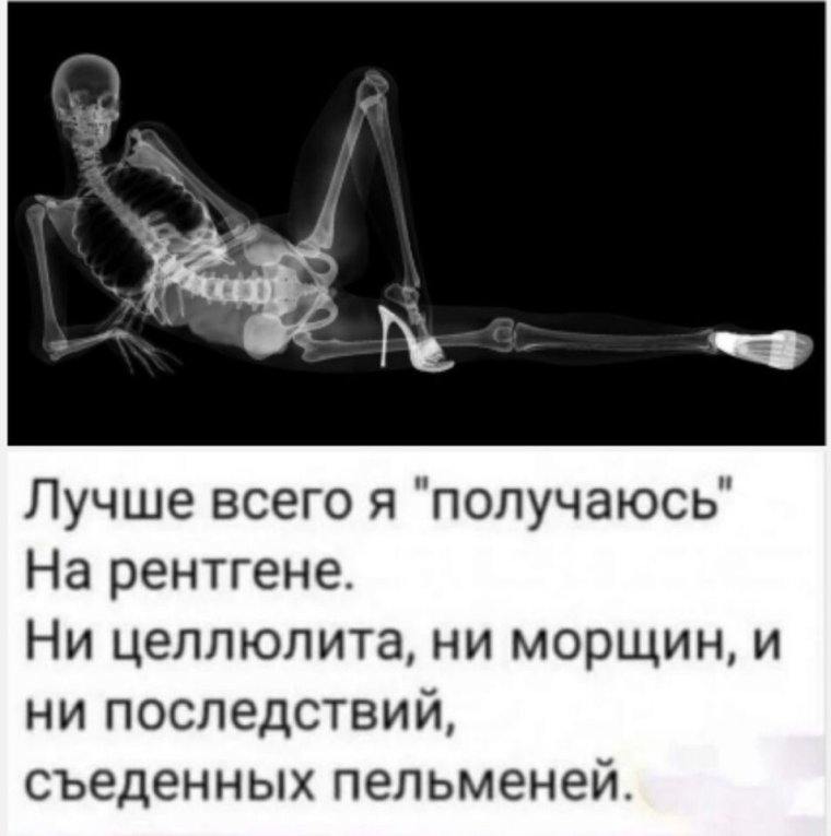 Лучше всего я получаюсь на рентгене ни целлюлита