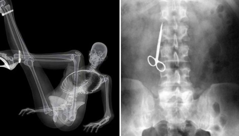 Самые смешные рентгеновские снимки