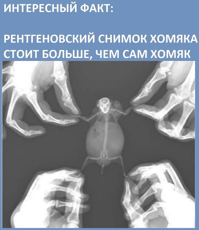 Рентгеновский снимок новорожденного