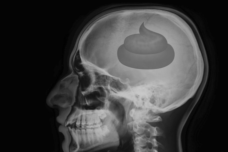 Рентген Мем