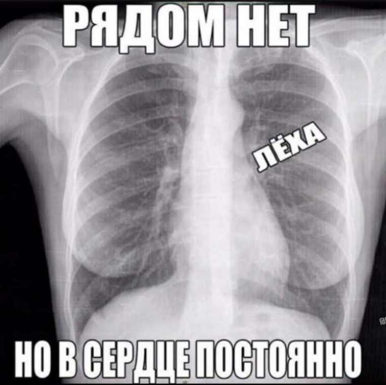 Рентген девушки