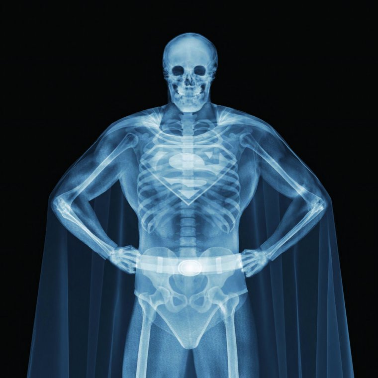 Рентгеновское изображение