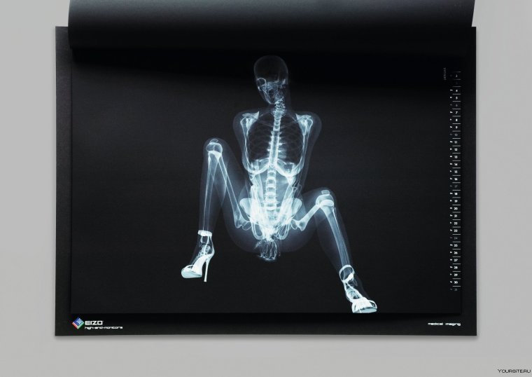 Рентген ноутбука