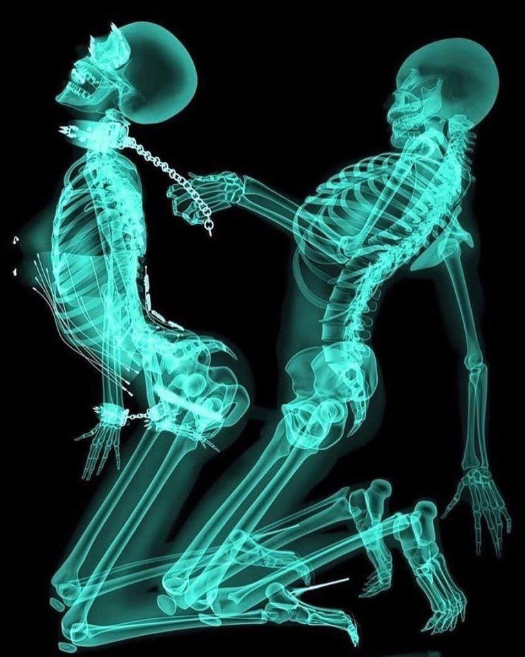 Необычные рентгеновские снимки