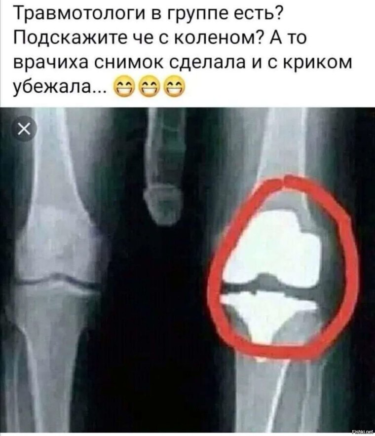 Доктор с рентгеновским снимком колен