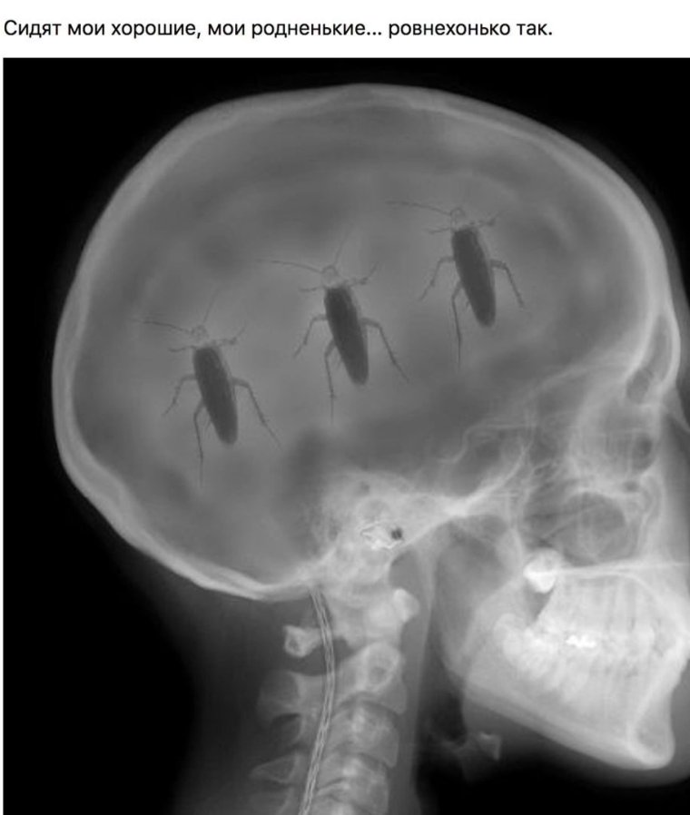 Шуточный рентген