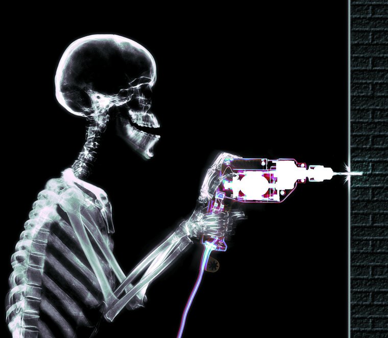 Прикольные рентгеновские снимки