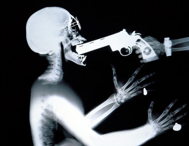 Смешной рентген