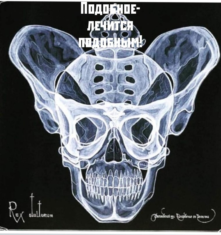 Прикольные рентгеновские снимки черепа