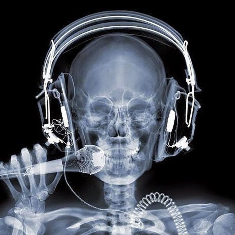 Скелет человека рентген