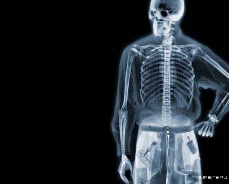Скелет рентген