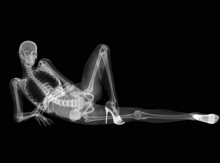 Скелет рентген