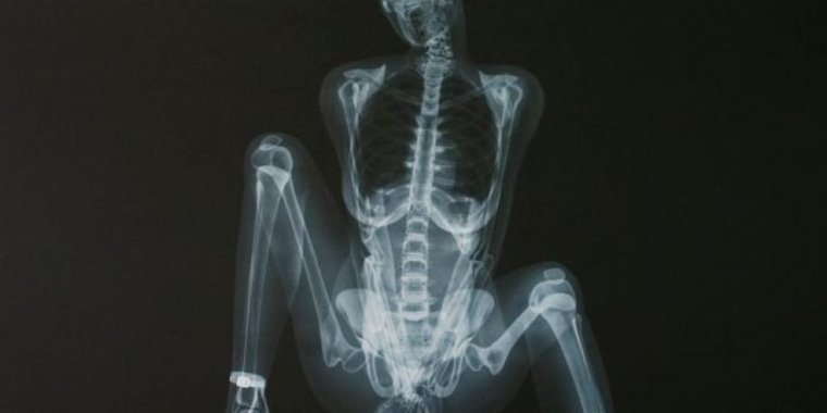 Ник визи. X-ray men