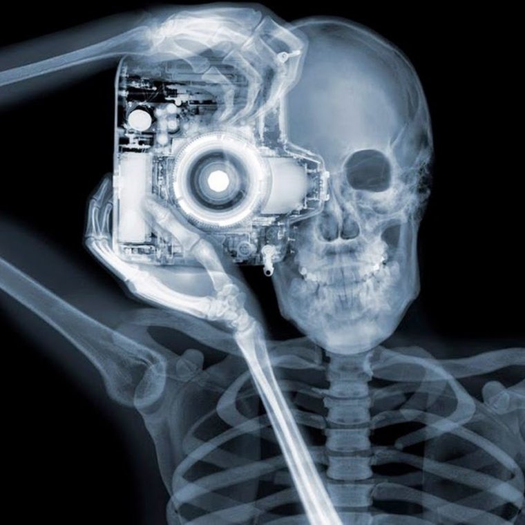 Рентген человека