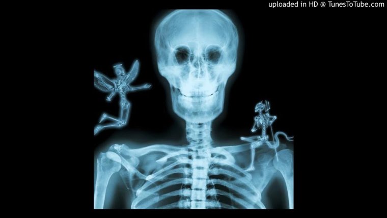 Рентген человека прикол