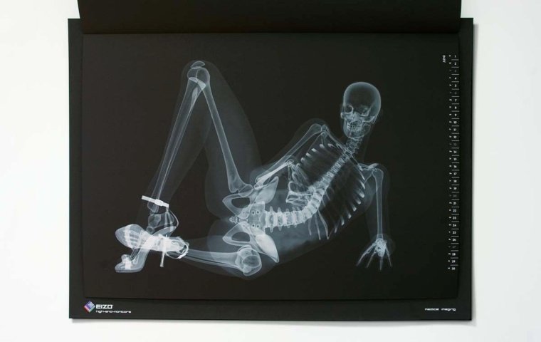 Рентгеновские снимки